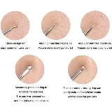 Alat Pencet Mengeluarkan Jerawat Dan Komedo Acne Removal 4pcs — 7